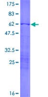 Human FBL / FIB / Fibrillarin Protein (Recombinant GST)