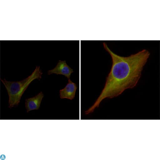 KRT15 / CK15 / Cytokeratin 15 Antibody