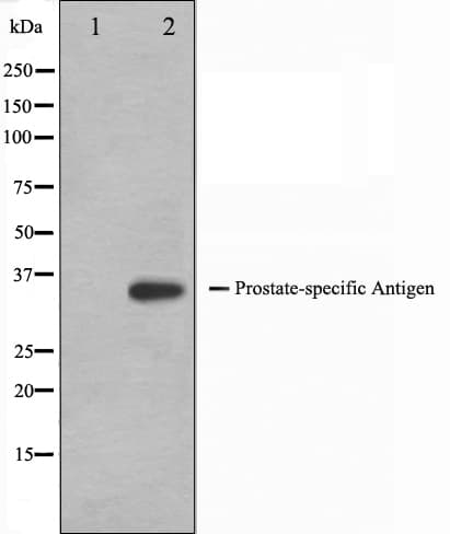 KLK3 / PSA Antibody