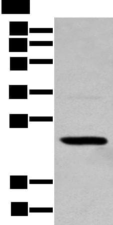 Polyclonal Rabbit anti-Human TCEAL4 Antibody (WB)