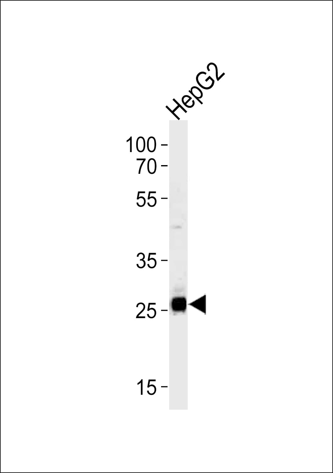 SIRT3 / Sirtuin 3 Antibody (aa250-279)