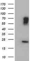 BIRC3 / cIAP2 Antibody (aa255-529, clone OTI1E3)