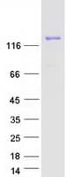 Human ULK4 Protein (Recombinant Myc-DDK (Flag))