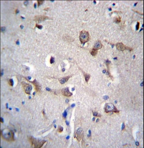Polyclonal Rabbit anti-Human YIF1B Antibody (aa82-110, IHC, WB)