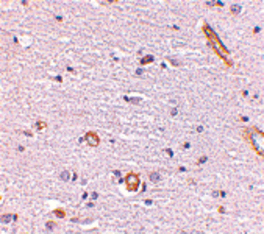 SNPH Antibody