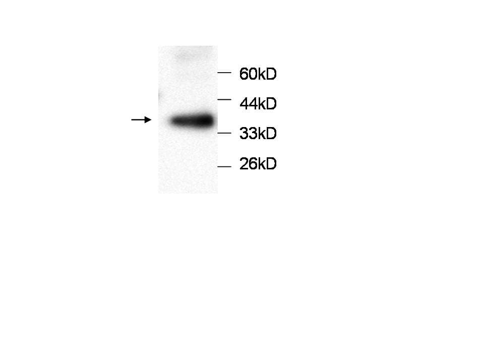 Monoclonal Mouse anti-Human PRDX3 / Peroxiredoxin 3 Antibody (WB)
