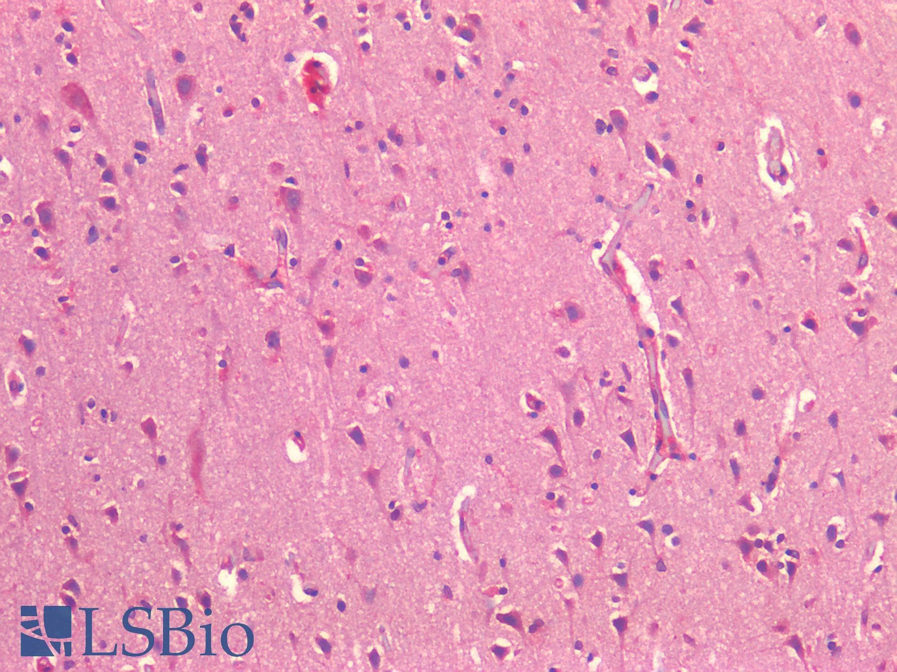 IHC-plus™ CX3CL1 / Fractalkine Antibody