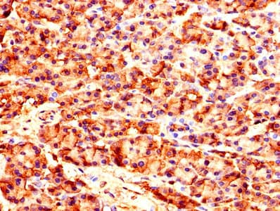 Polyclonal Rabbit anti-Human CARS1 / CARS Antibody