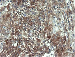 Monoclonal Mouse anti-Human VBP1 Antibody (clone OTI2C2, IHC, WB)