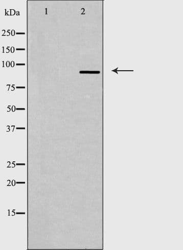 DDX20 / GEMIN3 Antibody