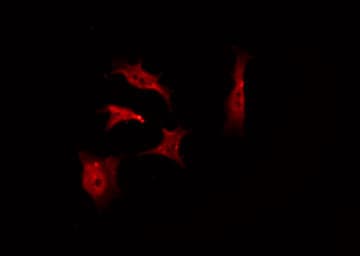 PRKCA / PKC-Alpha Antibody (phospho-Thr638)
