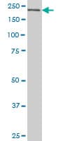 CDC42BPB / MRCKB Antibody (clone 2F4)