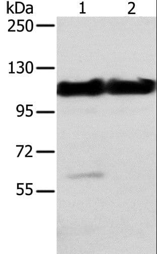 ACTN2 Antibody