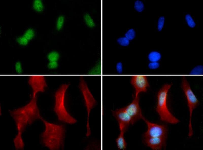CBFA1 / RUNX2 Antibody