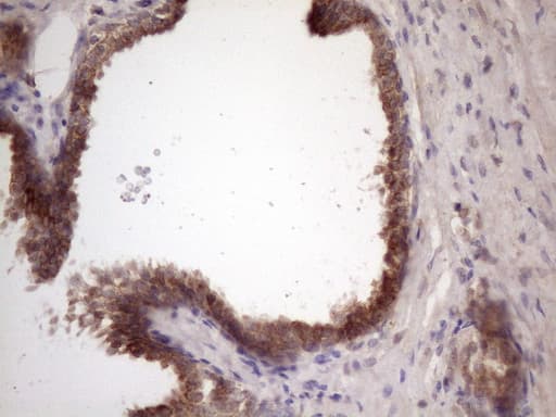 Monoclonal Mouse anti-Human BMF Antibody (clone OTI6F3, IHC, WB)