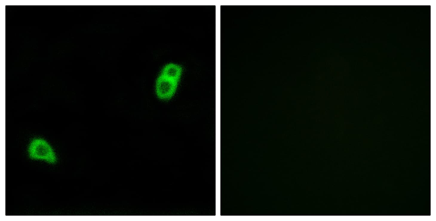 IHC-plus™ GPR34 Antibody (aa181-230)