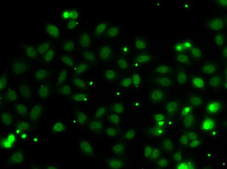 NGFRAP1 / NADE / Bex Antibody