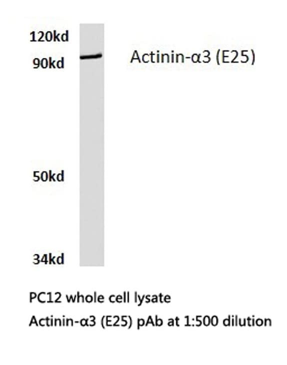 ACTN3 Antibody (Glu25)