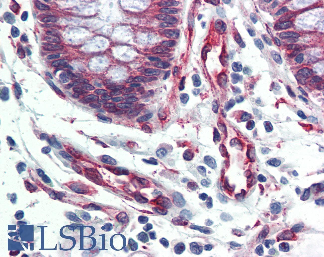 IHC-plus™ SERPINH1 / HSP47 Antibody (clone M16.10A1)