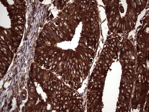 PKM2 Antibody (clone OTI12D5, Carrier-free)