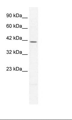 PITX2 / RGS Antibody (aa20-69)