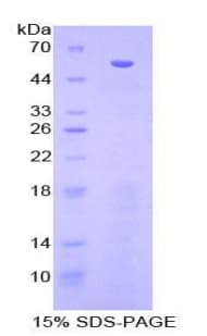 Human HSPBP1 Protein (Recombinant His-GST)