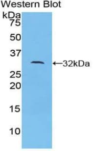 DOCK180 / DOCK1 Antibody (aa1200-1435)