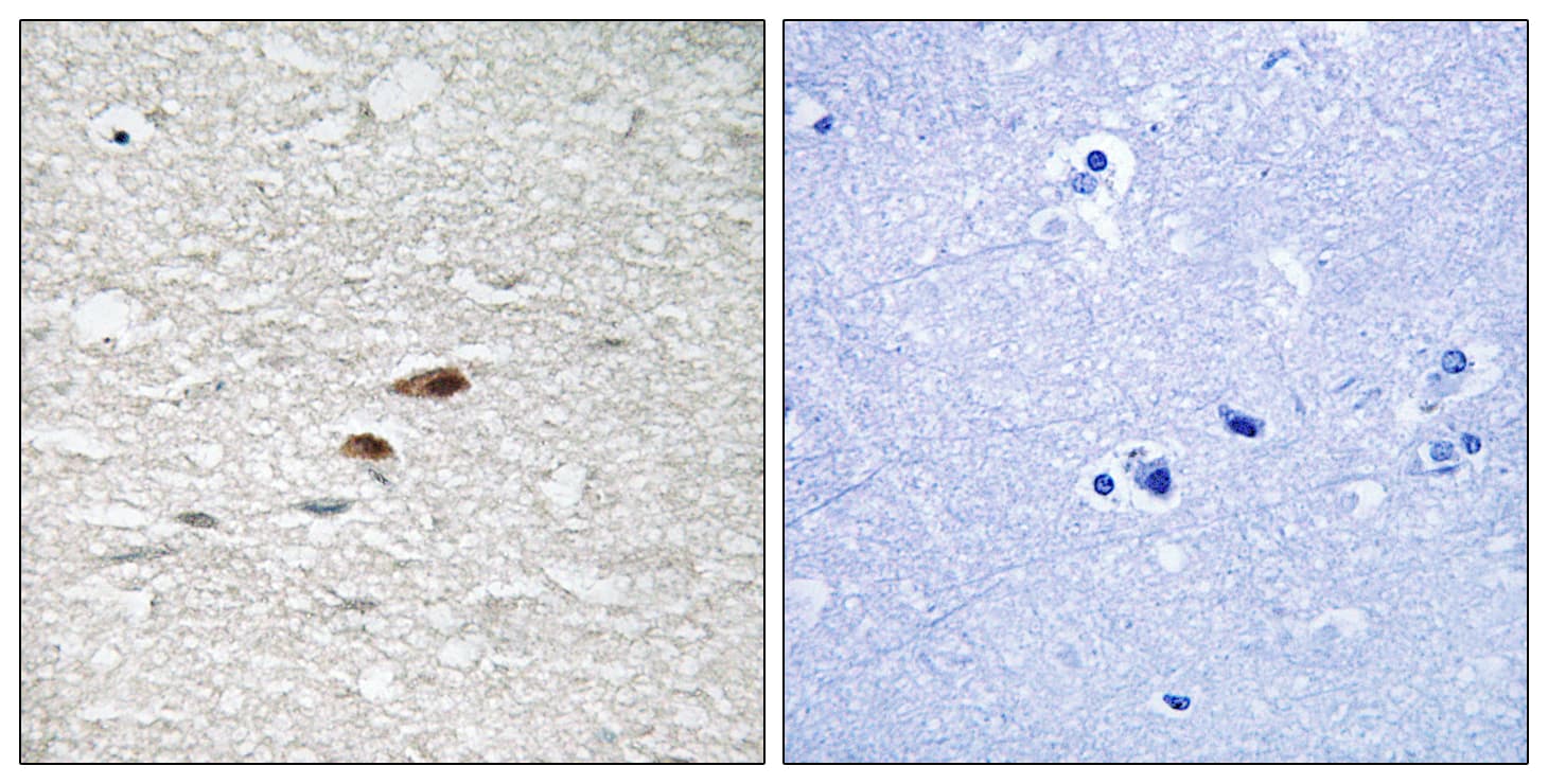 Polyclonal Rabbit anti-Human APC Antibody (phospho-Ser2054, IHC, WB)