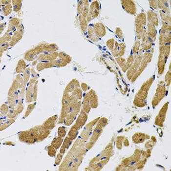 Polyclonal Rabbit anti-Human MYO10 / Myosin-X Antibody (IHC)