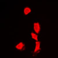 IHC-plus™ HDAC6 Antibody (N-Terminus)