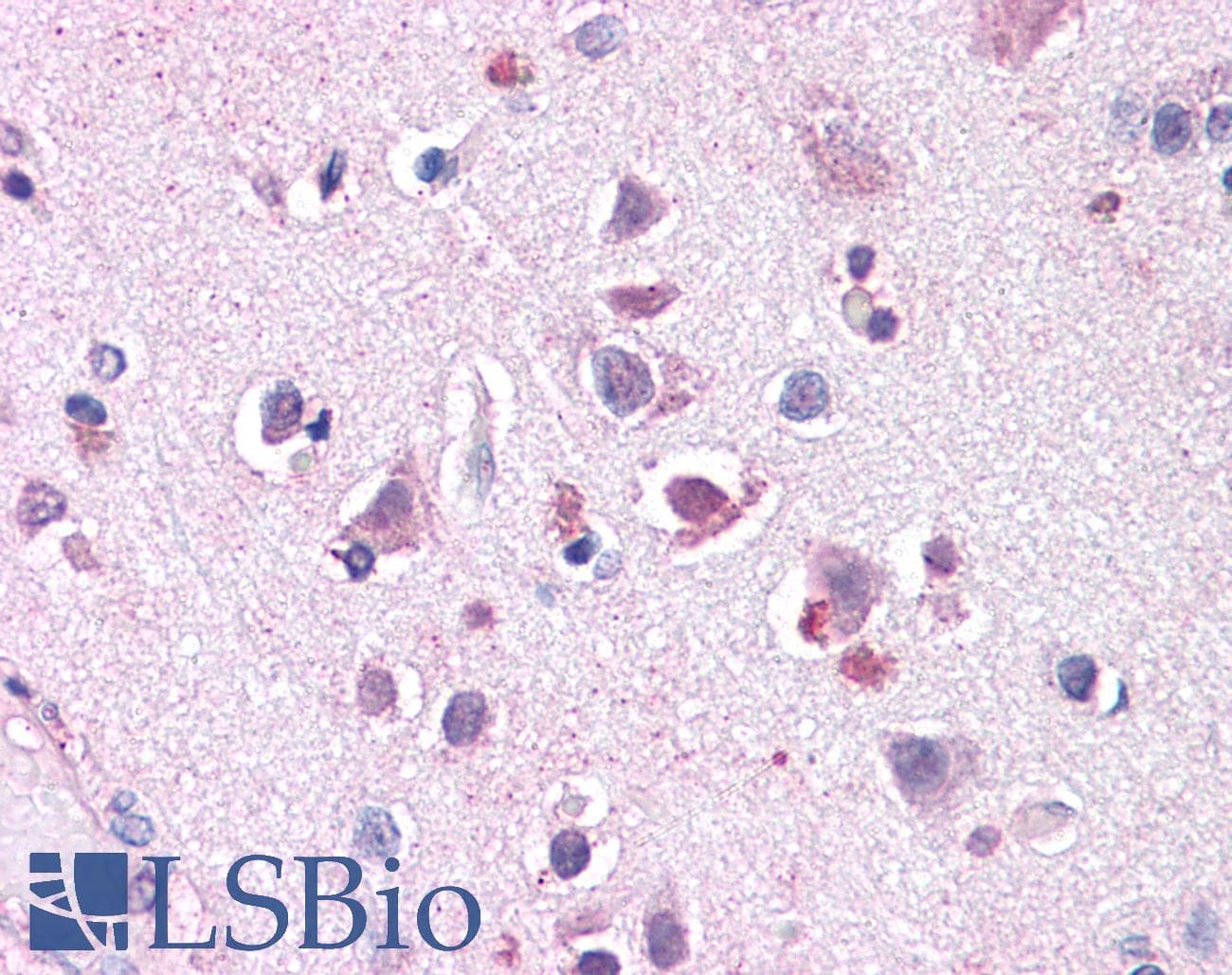 IHC-plus™ SLC29A1 / ENT1 Antibody (Internal)