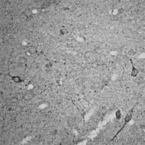 RHOA Antibody (aa100-150)