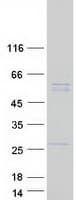 Human UBQLNL Protein (Recombinant Myc-DDK (Flag))