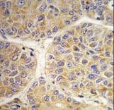 AASS / LKR / SDH Antibody (aa264-294)