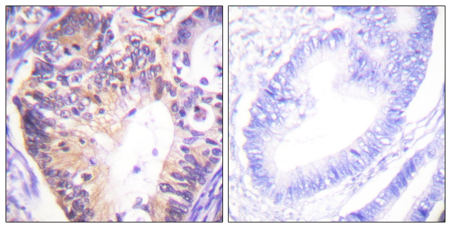 PAK1 Antibody (p212)