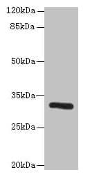 IHC-plus™ PPP1R3B Antibody