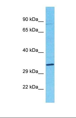 Polyclonal Rabbit anti-Human OS9 Antibody (C-Terminus, IHC, WB)