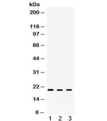 CRYAA / Alpha A Crystallin Antibody