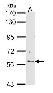 RCBTB2 Antibody (aa214-472)