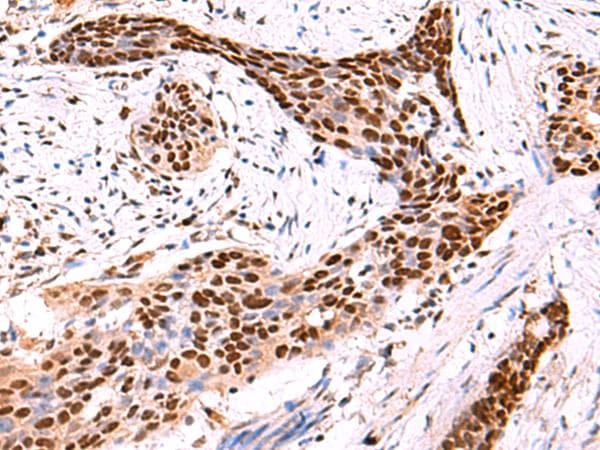 SOX2 Antibody