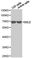 Polyclonal Rabbit anti-Human SELE / CD62E / E-selectin Antibody (IHC, WB)