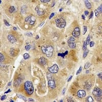 Polyclonal Rabbit anti-Human PRODH Antibody (IHC, WB)