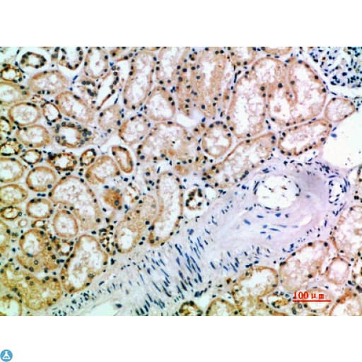KIR3DL2 Antibody