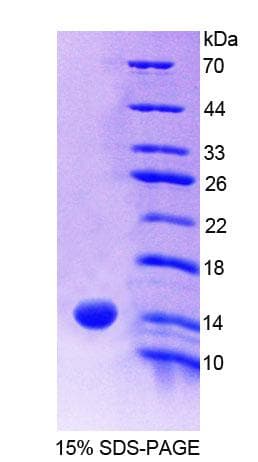Human S100A9 / MRP14 Protein (Recombinant His)