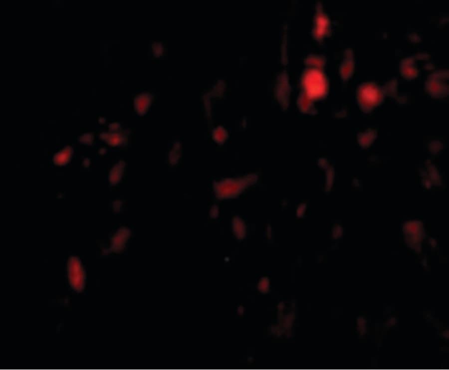 IHC-plus™ Polyclonal Rabbit anti-Human CAPN6 / Calpain 6 Antibody (IHC, IF, WB)