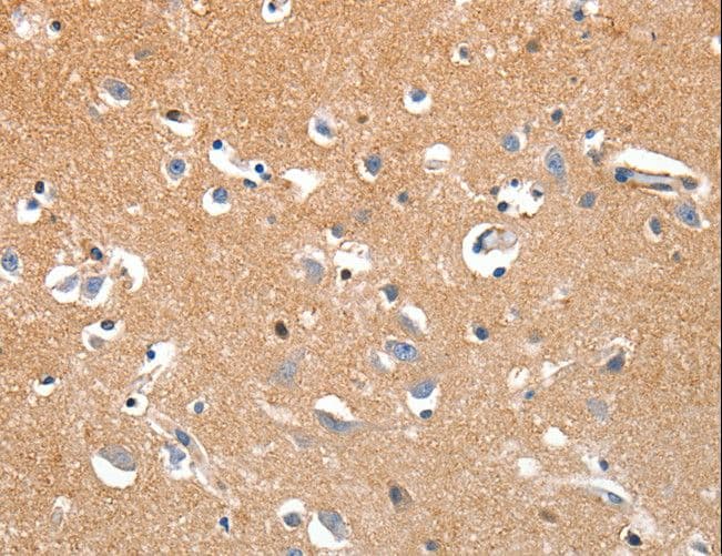 Polyclonal Rabbit anti-Human LRP3 Antibody (IHC)