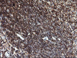 CD45 / LCA Antibody (clone OTI3D8, Carrier-free)