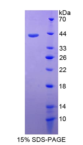 Bovine CD3D Protein (Recombinant His-GST)