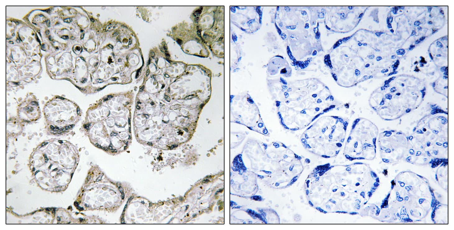 Polyclonal Rabbit anti-Human ME2 / Malate Dehydrogenase 2 Antibody (aa201-250, IHC, WB)