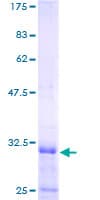 Human RPL39L Protein (Recombinant GST)